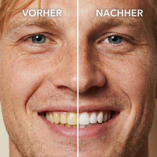 The (VIRAL) W.O.W Teeth Cleaning Paste